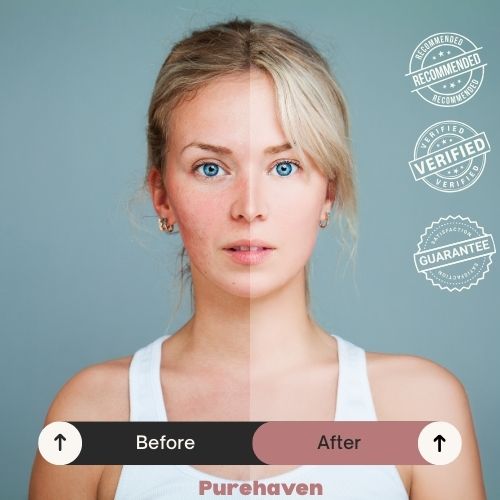 PureHaven™ – UK’s Favorite Shower Head for Softer Skin & Healthier Hair